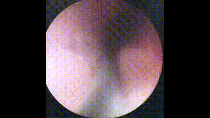 6.gif