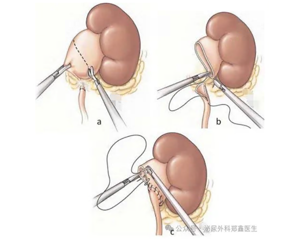 微信图片_20250618104149.png