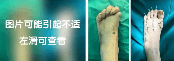 拼3.jpg