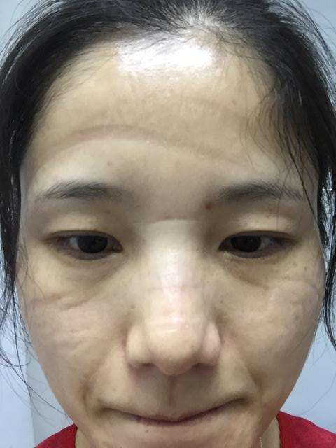 s_刘洋摘口罩202003041601499.jpg